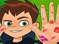 Žaidimas „Ben10“ rankų daktaras  internete