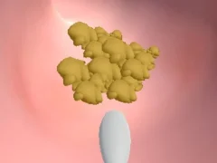 Žaidimas Earwax Clinic internete