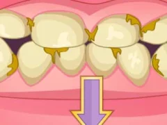 Žaidimas Bad Teeth Makeover internete