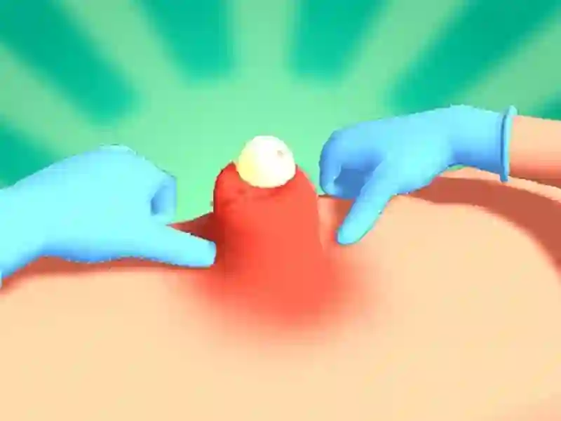 Žaidimas Pimple Squeeze internete