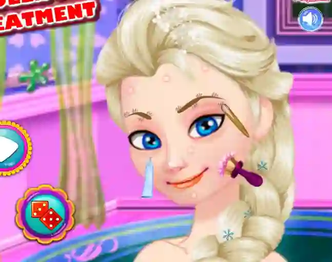 Žaidimas Ice Queen Acne Treatment internete