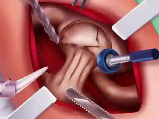 Žaidimas Princess Hips Surgery internete