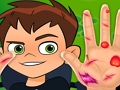 Žaidimas „Ben10“ rankų daktaras  internete
